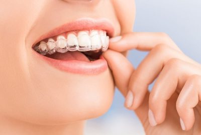 dental-patient-wearing-suresmile1-32526631631
